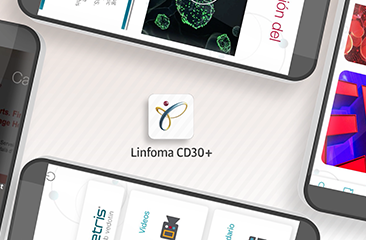 Linfoma CD30+
